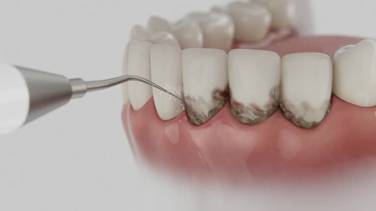 Reliable Dental contractor in New Bremen, OH by Dentist Open Now